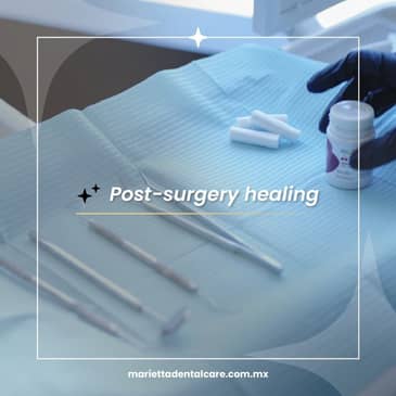 Slider image (4) Marietta Dental Care Los Algodones